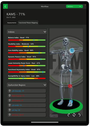Kinetisense 3D movement scan